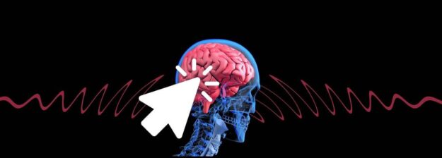 Image of brain